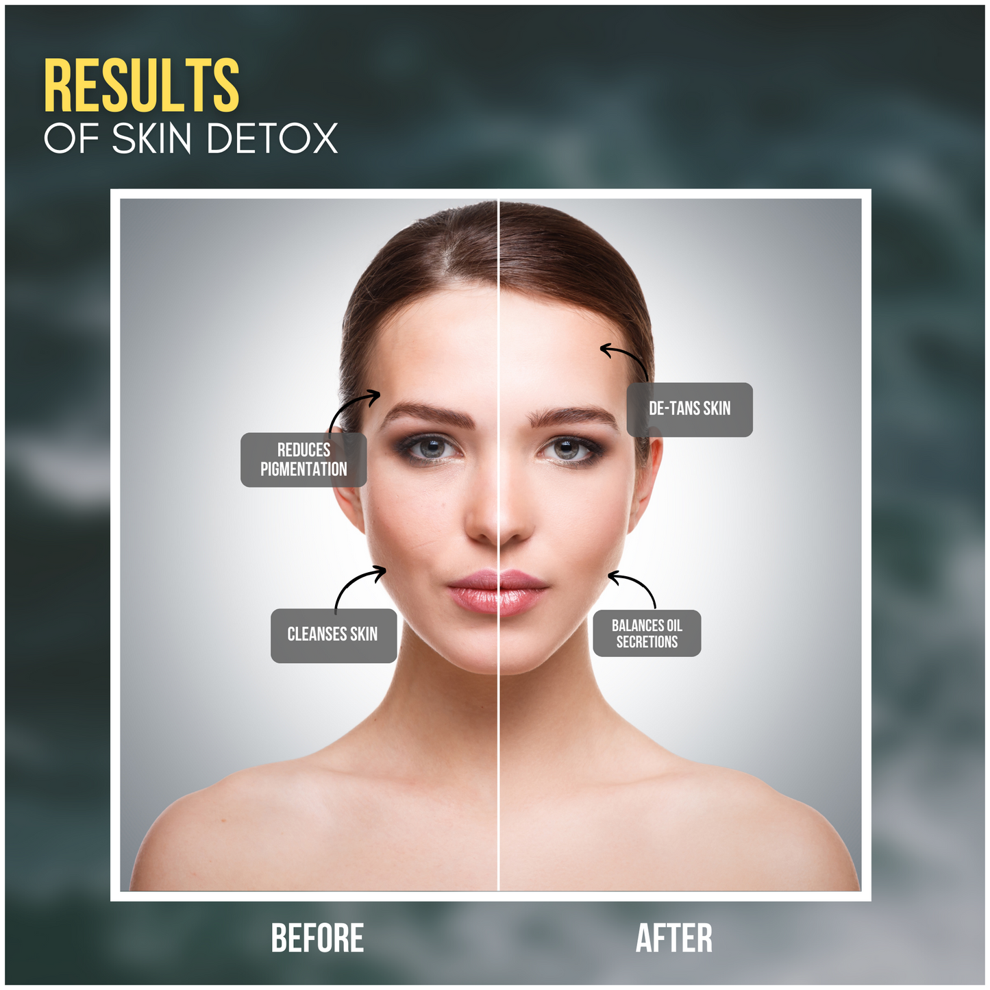SKIN DETOX MASK